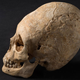 Image for article titled French Archaeologists Discover Beautifully Preserved Deformed Skull